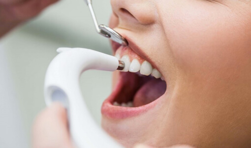 dental treatment
